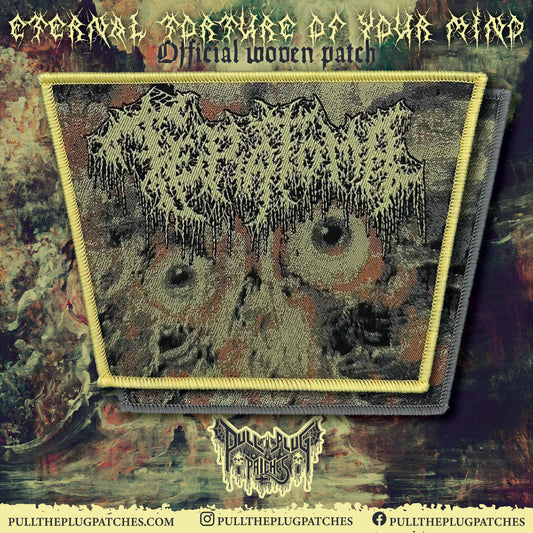 Teratoma - Purulent Manifestations